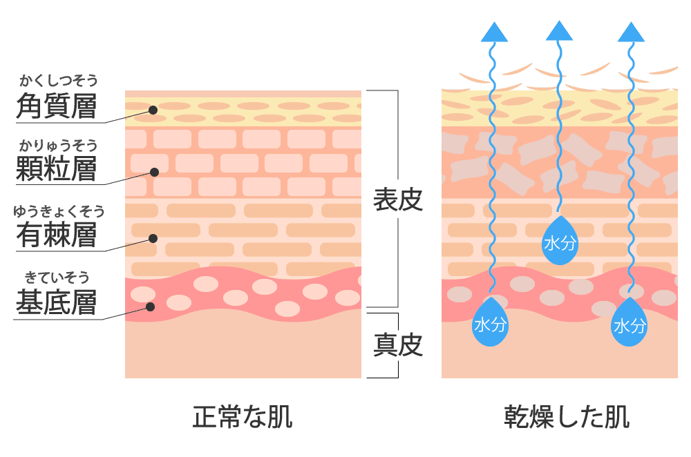 乾燥肌原因